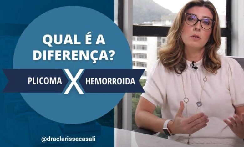 Compreendendo a Diferença entre Plicoma e Hemorroida