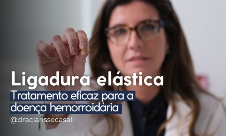 Ligadura Elástica para Hemorroidas: Entenda por que é uma opção eficaz