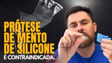 Prótese de silicone no queixo: o que pode dar errado com o tempo?