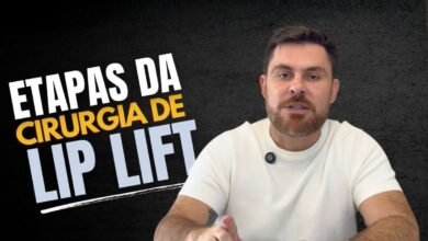 Cirurgia de lip lift: etapas, recuperação e o que esperar do procedimento