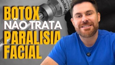 Botox não trata paralisia facial, o que realmente funciona