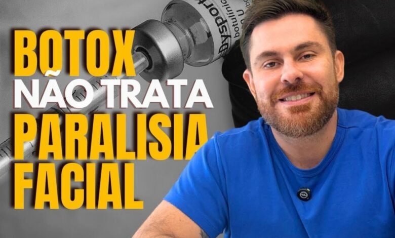 Botox não trata paralisia facial, o que realmente funciona