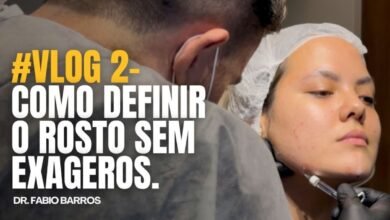 Como definir o rosto sem exageros com a harmonização de mandíbula e mento