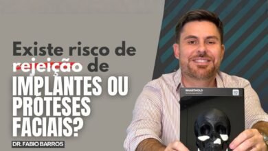 Existe risco de rejeição de implantes faciais?