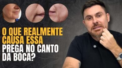 O Que Causa a Prega no Canto da Boca? Entenda a Verdadeira Origem do Problema e Como Tratar de Forma Natural