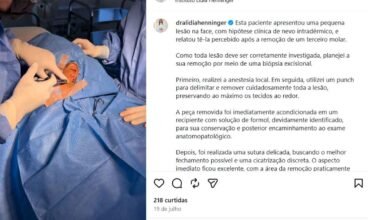 Biópsia excisional de lesão facial: diagnóstico seguro